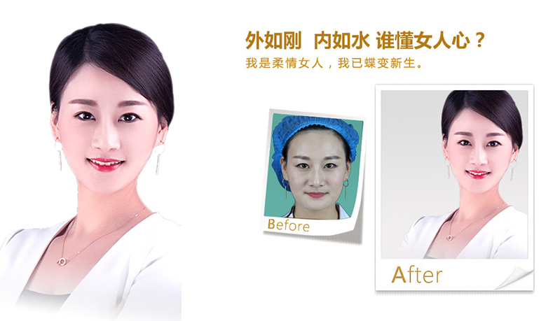丹阳V脸、线雕隆鼻